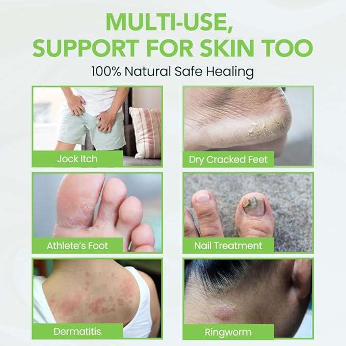 Thena Athletes Foot Cream Extra Strength Herbal Relief with Tea Tree Neem & Menthol, Athletes Foot Treatment Balm for Itchy Dry Cracked Feet, Heels and Toes, Advanced Plant-Based Foot Care