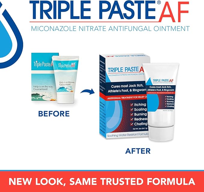 Triple Paste AF Antifungal Ointment for Skin, Athletes Foot Treatment and Ringworm Treatment - 2% Miconazole Antifungal Cream - 2 Oz Tube (Pack of 2) (Packaging May Vary)
