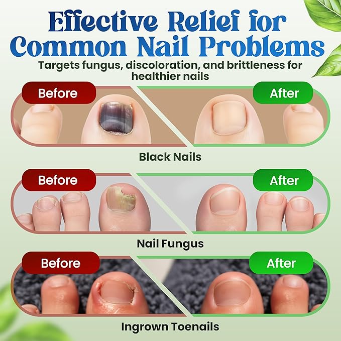Premium Fungal Nail Patches Toenail Care Extra Fungus Strength 42 Pcs Nighttime Repair Damaged Treatment Discolored Nails 8 Hour Safe Sensitive Skin Easy Apply Women Men gift (42 Count)